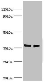 Polyclonal Rabbit anti-Human HNRNPD / AUF1 Antibody (aa1-306, IHC, WB)