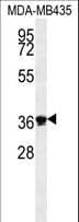 Polyclonal Rabbit anti-Human EXO5 / Exonuclease 5 Antibody (aa166-193, WB)
