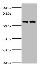 PAK2 Antibody (aa1-212)