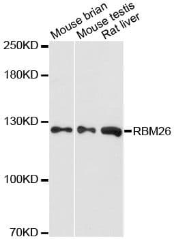 RBM26 / SE70 Antibody