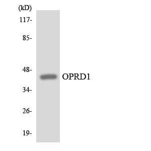 OPRD1 / Delta Opioid Receptor Antibody (aa296-345)
