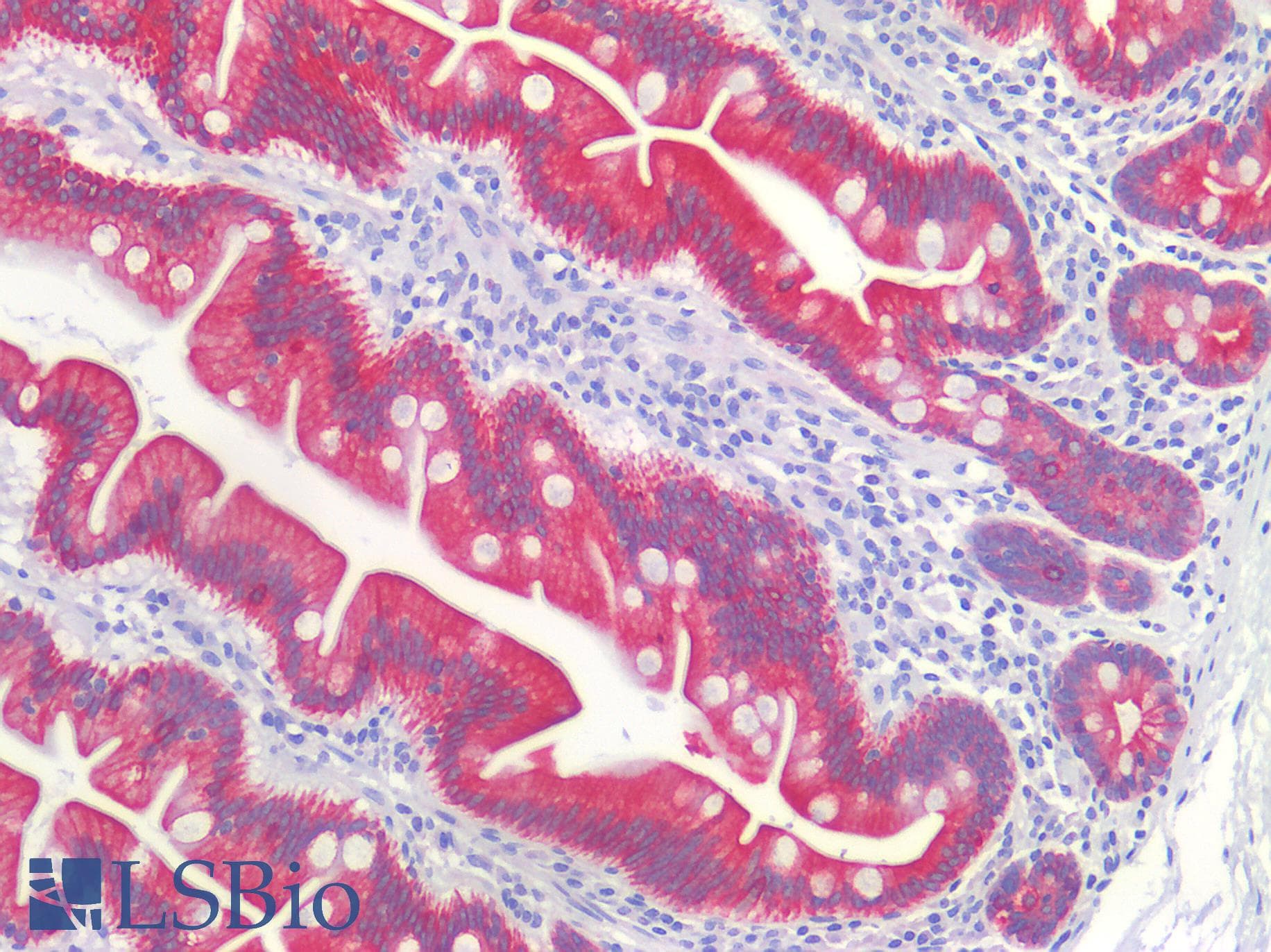 Polyclonal Rabbit anti-Human ST14 / Matriptase Antibody (C-terminal, IHC, WB)