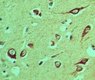 IHC-plus™ Polyclonal Rabbit anti-Human NLRX1 Antibody (aa580-630, IHC, WB)