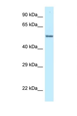 ZNF384 Antibody (C-Terminus)