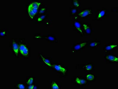 DNAJC6 Antibody