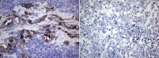 Monoclonal Mouse anti-Human ROS1 / ROS Antibody (clone OTI1E6, aa2126-2347, IHC, WB)