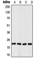 VHL / Von Hippel Lindau Antibody (N-Terminus)