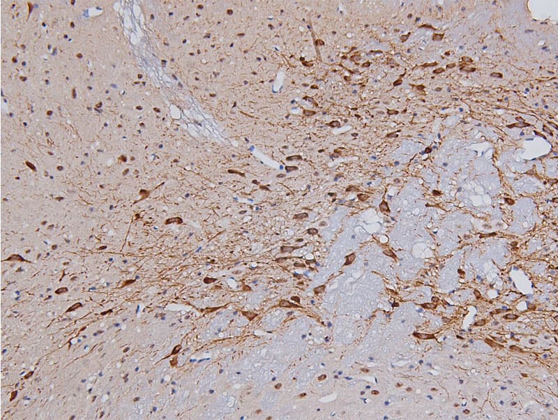 TH / Tyrosine Hydroxylase Antibody (phospho-Ser31)