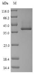 Staphylococcus aureus HLB Protein (Recombinant 6His, N-terminus)