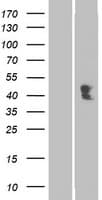 ACPT Protein (Over-Expression Lysate Myc-DDK (Flag))
