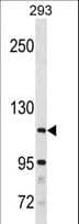 Polyclonal Rabbit anti-Human SH3BP4 Antibody (aa402-429, WB)