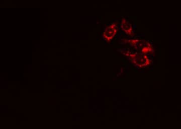 Thymidylate Kinase Antibody