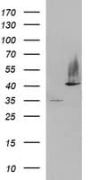 SERPINB3 Antibody (clone OTI2B9)