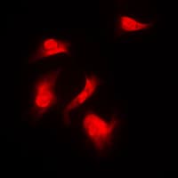 RPS6KB1 / P70S6K / S6K Antibody (phospho-Ser418)