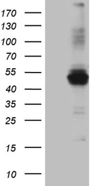 AGPAT9 / MAG1 Antibody (aa41-131, clone OTI1D11)