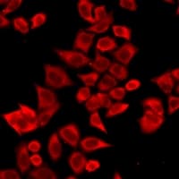 IL17F Antibody