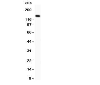 FLT1 / VEGFR1 Antibody (aa278-298)