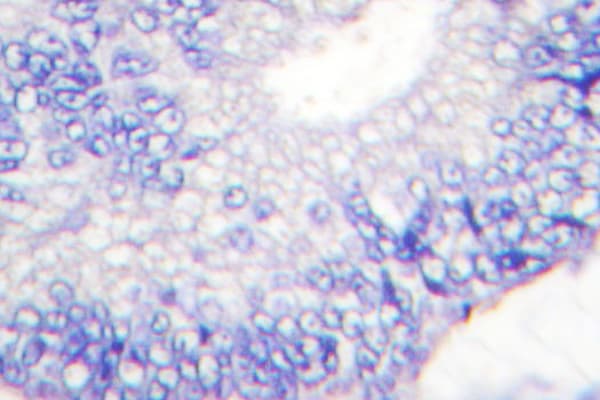 TGFA / TGF Alpha Antibody (Arg139)