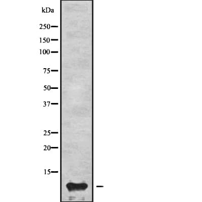 APOC3 / Apolipoprotein C III Antibody