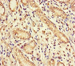 Polyclonal Rabbit anti-Human GUCY1A1 / GUCY1A3 Antibody (IHC, IF)
