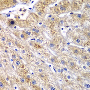 Dipeptidyl Peptidase 3 / DPP3 Antibody