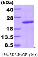 Human PPIG / Cyclophilin G Protein (Recombinant His)