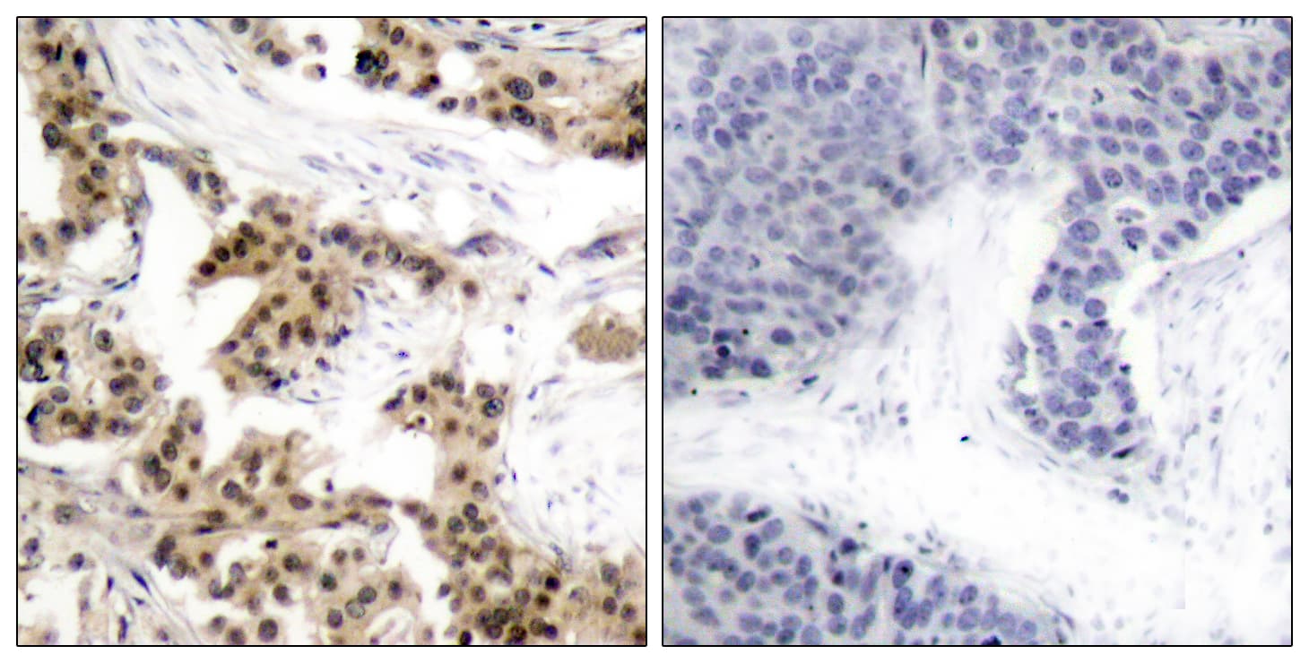 NFKB1 / NF-Kappa-B Antibody (phospho-Ser893)