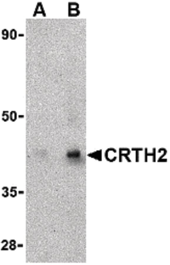 Polyclonal Rabbit anti-Human GPR44 / CRTH2 Antibody (IHC, IF, WB)