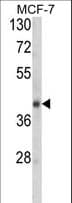 Polyclonal Rabbit anti-Human SERPINA9 Antibody (aa194-222, IHC, WB)