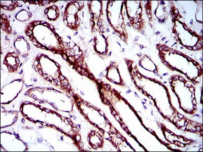Monoclonal Mouse anti-Human RPL18A Antibody (clone 6G6G10, aa50-176, IHC, IF, WB)