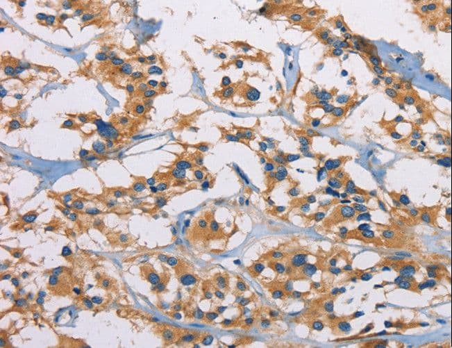 Polyclonal Rabbit anti-Human Ceramide Kinase / CERK Antibody (IHC)