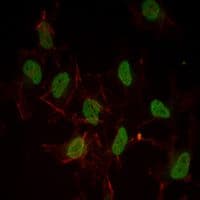 ER Alpha / Estrogen Receptor Antibody (clone 6B6)
