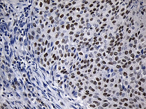 Monoclonal Mouse anti-Human ZNF670 Antibody (clone OTI6E10, IHC, WB)