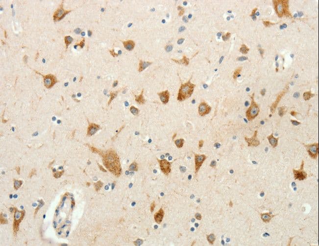 RPAP3 / FLJ21908 Antibody