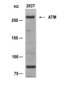 ATM Antibody