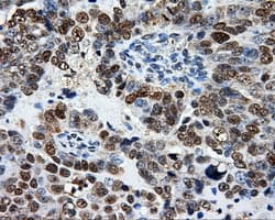 ATP5B / ATP Synthase Beta Antibody (clone OTI1F7, Carrier-free)