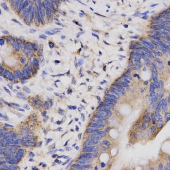 Polyclonal Rabbit anti-Human CBLB Antibody (IHC, WB)