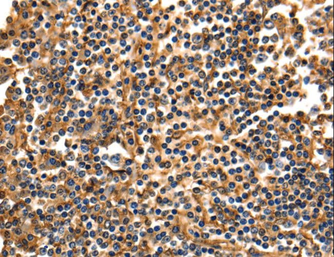 ANXA5 / Annexin V Antibody