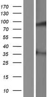 MAP9 Protein (Over-Expression Lysate Myc-DDK (Flag))
