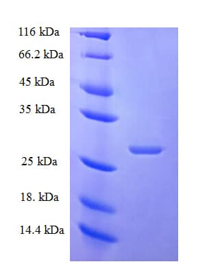 Human ZNRD1 Protein (Recombinant His-SUMO)