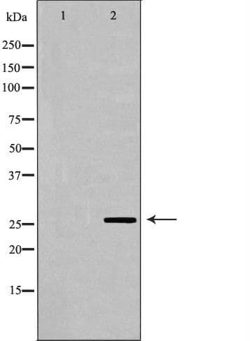 GSTA1 Antibody