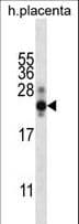 CGB / hCG Beta Antibody (aa137-165)