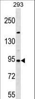 SEMA3D / Semaphorin 3D Antibody (aa611-640)