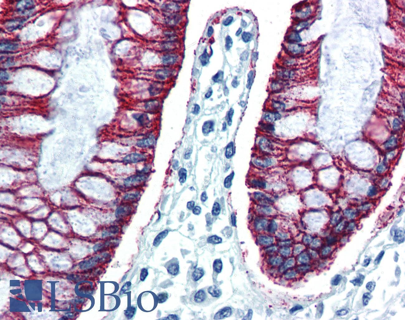 IHC-plus™ CLDN7 / Claudin 7 Antibody (C-Terminus)