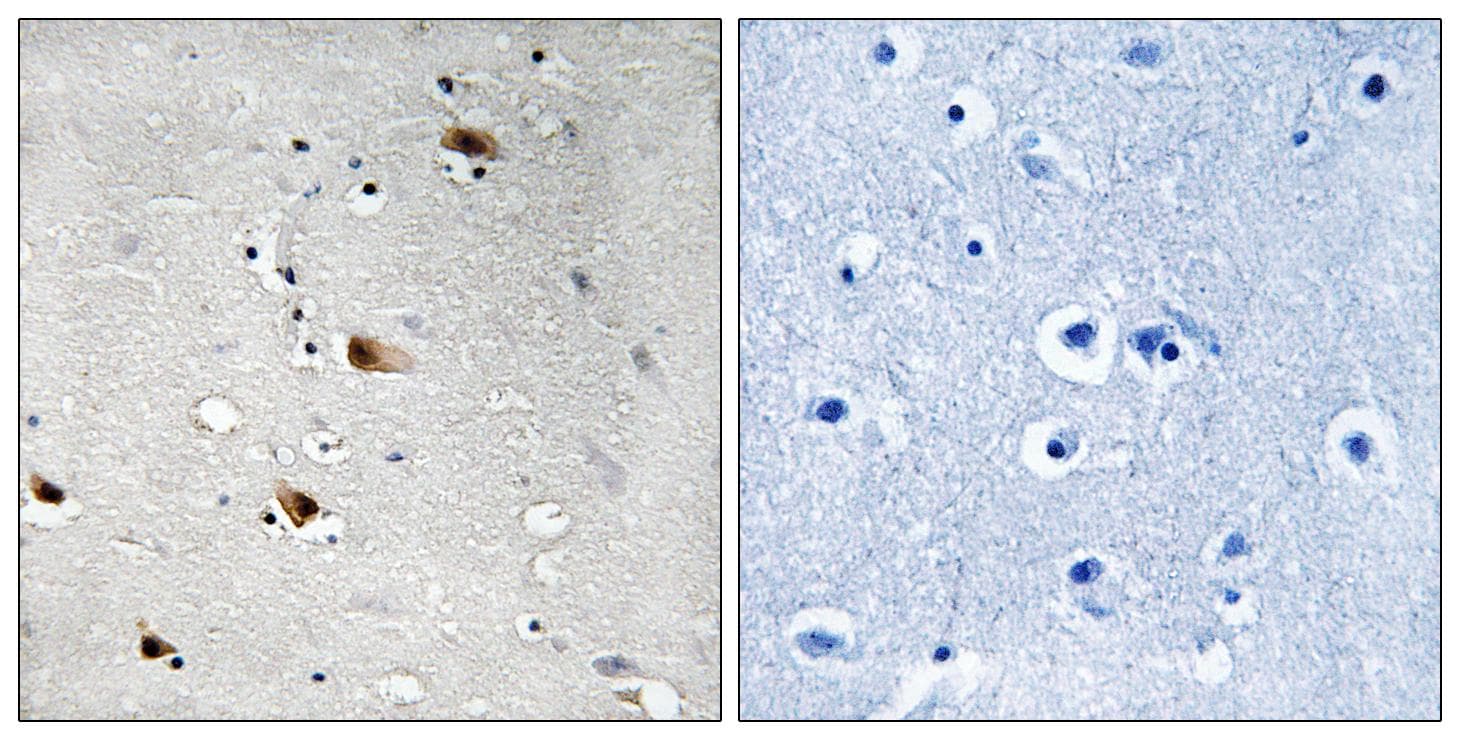 TCF3 / E2A Antibody (phospho-Thr355)
