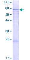 Human CYP27 / CYP27A1 Protein (Recombinant GST)