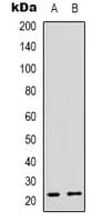 MRPL48 Antibody (C-Terminus)