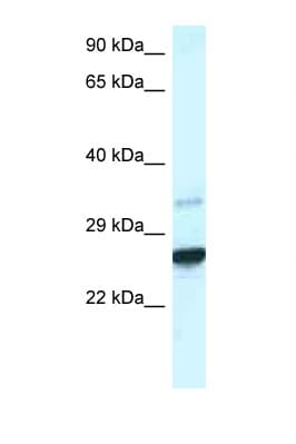 CDX1 Antibody (aa195-244)