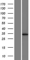 CCDC121 Protein (Over-Expression Lysate Myc-DDK (Flag))