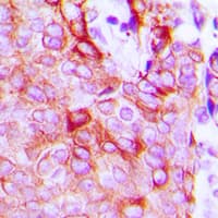 Polyclonal Rabbit anti-Human ADGRL2 / LPHN2 Antibody (aa556-595, IHC, WB)